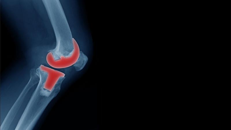 Total knee Replacement Surgery in Surat