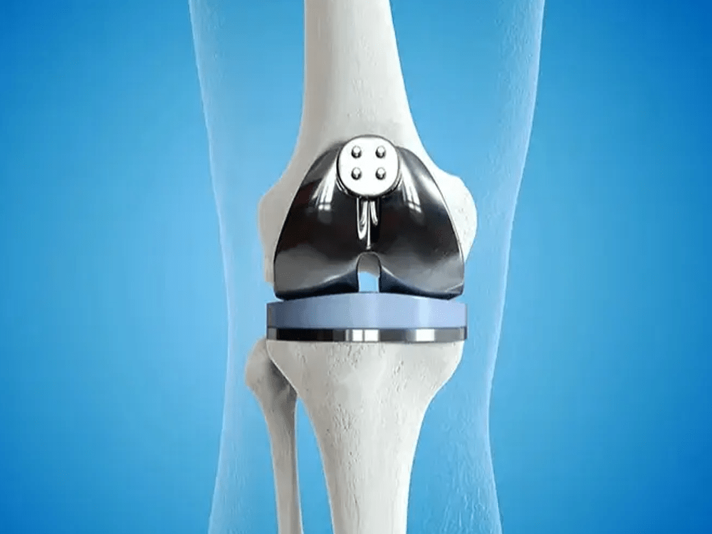 knee