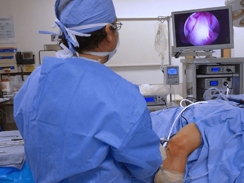 kneearscopy